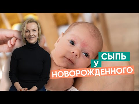 Видео: Сыпь в первые месяцы жизни