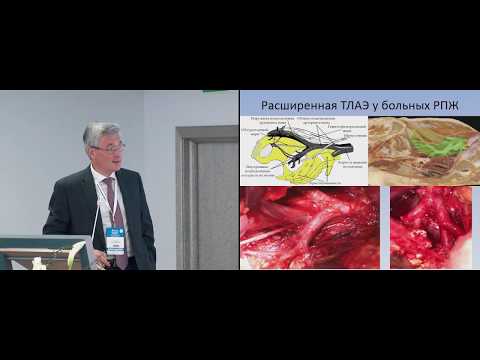 Видео: Микрометастазы в лимфатических узлах при раке предстательной железы и простатэктомии. Алексеев Б.Я.