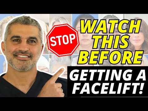 Видео: Думаете о подтяжке лица? ВСЁ, что вам нужно знать! Руководство для начинающих по подтяжке лица