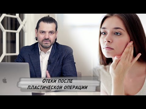 Видео: Когда пройдет отек на носу после ринопластики?