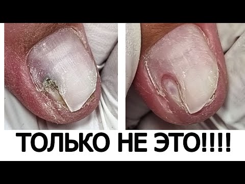 Видео: КОШМАР ///  опять ЭТО у нее СЛУЧИЛОСЬ(((