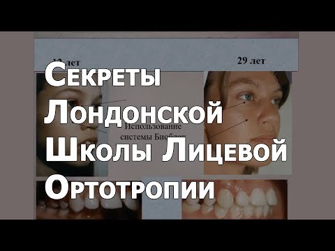 Видео: Секреты Лондонской Школы Лицевой Ортотропии