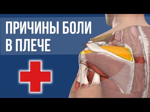 Видео: БОЛЬ в ПЛЕЧЕ | ТЕНДИНИТ ДЛИННОЙ ГОЛОВКИ БИЦЕПСА | Ротаторная Манжета | Импиджмент синдром