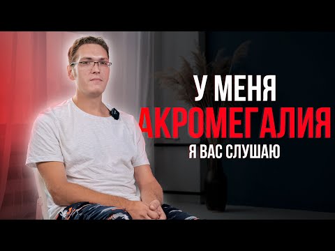 Видео: Бесконечный гормон роста - Акромегалия. Роман.