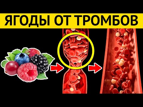 Видео: 10 разжижающих ЯГОД, которые навечно избавят от ТРОМБОВ и АТЕРОСКЛЕРОЗА!