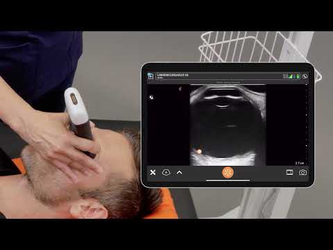 Видео: Ультразвуковая диагностика глаза (УЗИ сканер Clarius)