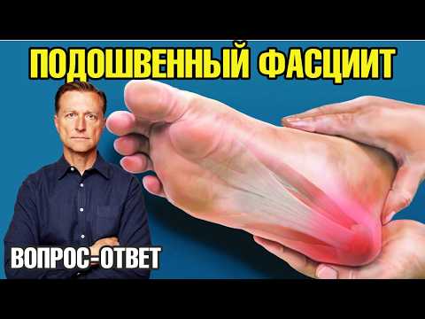 Видео: Пяточная шпора и боль в пятке. Подошвенный фасциит 👉 что делать?