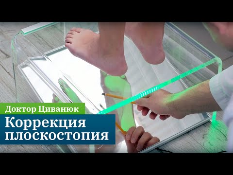 Видео: Коррекция плоскостопия. Прикладная кинезиология. Доктор Циванюк