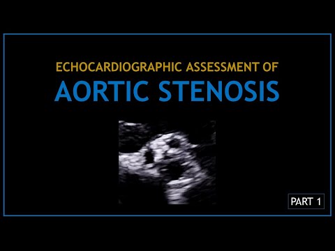 Видео: АОРТАЛЬНЫЙ СТЕНОЗ (Эхокардиографическая оценка) - ЧАСТЬ 1
