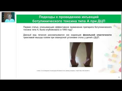 Видео: Ботулинотерапия в лечении спастичности верхней конечности у детей с ДЦП2021