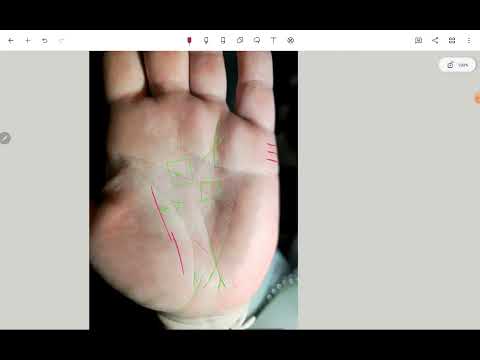 Видео: Хиромантия. Сердце. Желчный. Ноги. Союзы.