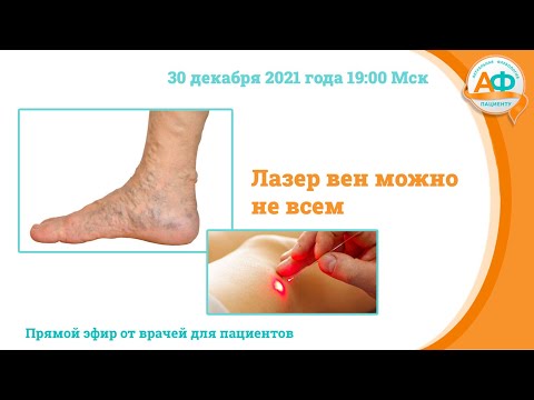 Видео: Лазер вен можно не всем
