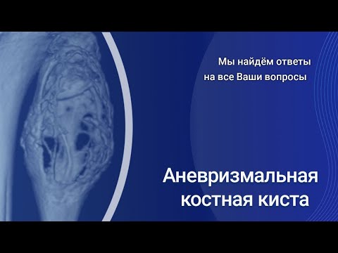 Видео: Аневризмальная костная киста