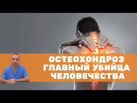 Видео: Диагноз, которого не существует, — что такое остеохондроз на самом деле