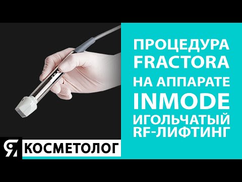 Видео: Процедура Fractora на аппарате InMode. Игольчатый RF-лифтинг