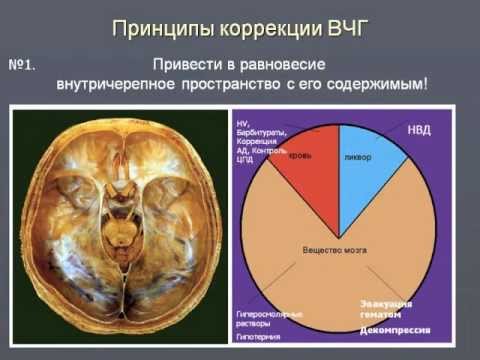 Видео: 1МСН ИТ острого периода тяжелой ЧМТ. Ошоров