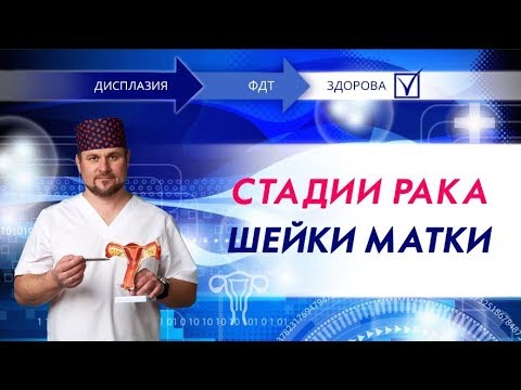 Видео: Стадии рака шейки матки