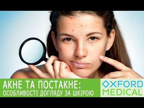 Видео: АКНЕ І ПОСТАКНЕ. ОСОБЛИВОСТІ ДОГЛЯДУ ЗА ШКІРОЮ