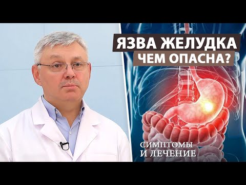 Видео: Что такое язва желудка и двенадцатиперстной кишки?