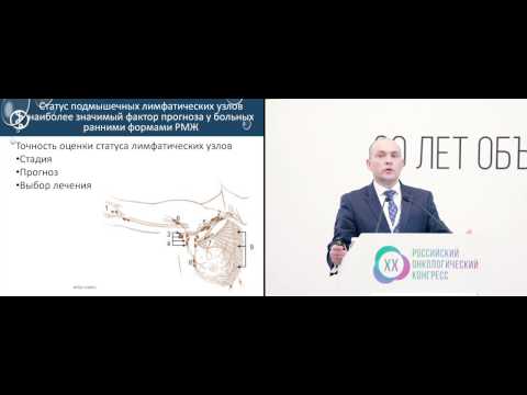 Видео: Биопсия сигнальных лимфатических узлов у больных раком молочной железы