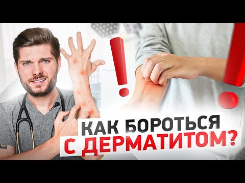 Видео: Атопический дерматит. Борьба с высыпаниями и как вылечиться РАЗ и НАВСЕГДА