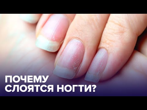 Видео: Почему СЛОЯТСЯ НОГТИ: 5 причин, о которых вы не знаете