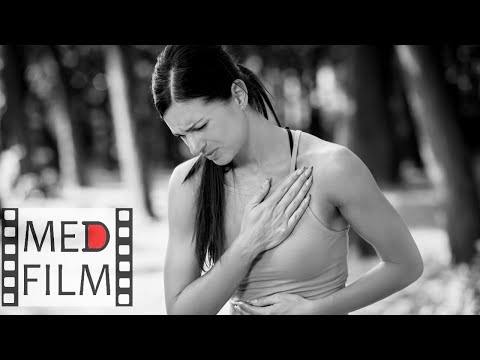 Видео: Антиаритмические препараты © pharmacology of anti-arrhythmic drugs