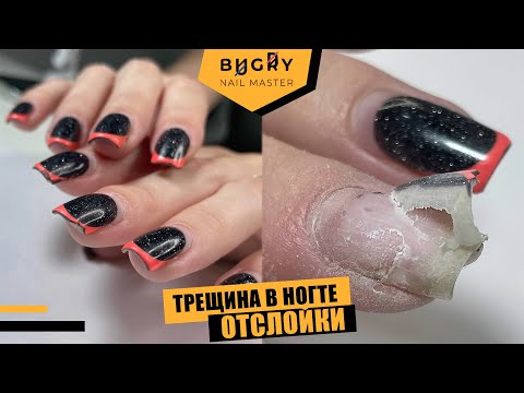Видео: КОРРЕКЦИЯ НОГТЕЙ / СОВЕТЫ В РАБОТЕ С ВЛАЖНЫМИ РУКАМИ / ТРЕЩИНА НОГТЯ #ТатьянаБугрий
