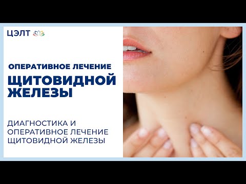 Видео: 👉 Диагностика и оперативное лечение щитовидной железы. Оперативное лечение щитовидной железы. 12+