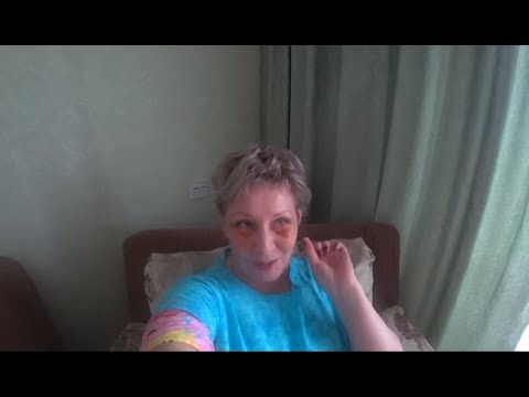 Видео: 19.03.20 БЛЕФАРОПЛАСТИКА. Восстановление. 2-я часть.