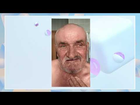 Видео: Реконструкция мягкотканных дефектов при раке слизистой оболочки полости рта - Кропотов М А