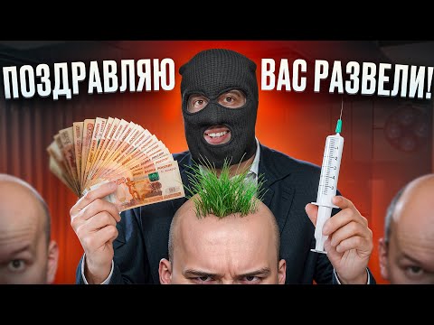 Видео: КАК ВАС РАЗВОДЯТ КЛИНИКИ ПО ПЕРЕСАДКЕ ВОЛОС?