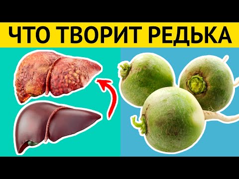 Видео: Даже одна долька ЗЕЛЕНОЙ РЕДЬКИ вызывает НЕОБРАТИМЫЕ ПРОЦЕССЫ в организме. Медики шокированы!