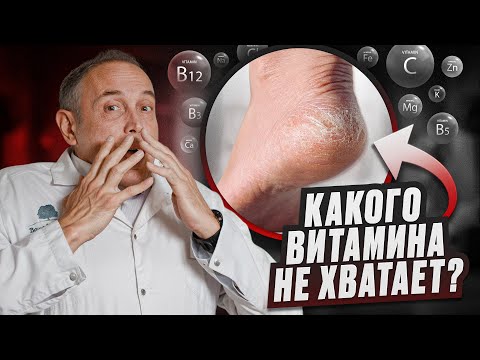 Видео: Самые важные витамины после 50