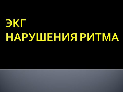 Видео: ЭКГ. Нарушения ритма сердца. Максимцева Е. А.