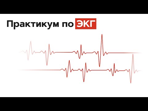 Видео: Практикум по ЭКГ с молодыми врачами. Часть 1. 01.10.21