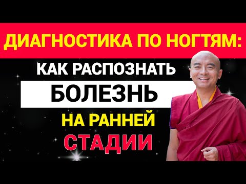Видео: Диагностика по ногтям: как распознать болезнь на ранней стадии?