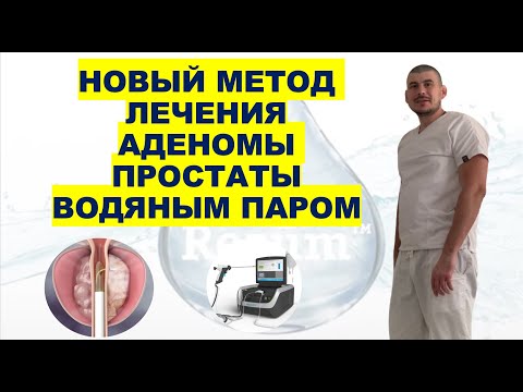 Видео: НОВЫЙ МЕТОД ЛЕЧЕНИЯ АДЕНОМЫ ПРОСТАТЫ ВОДЯНЫМ ПАРОМ