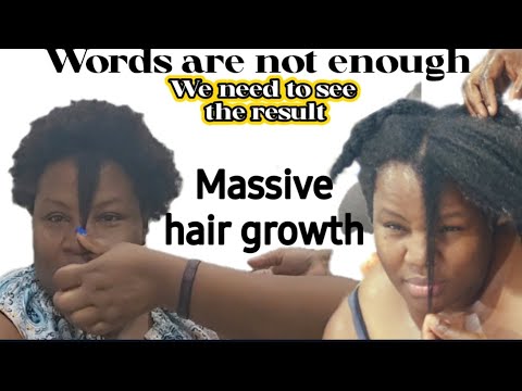 Видео: Отращивайте волосы на 1 дюйм каждый месяц и сохраняйте результат. Выполните эти 2 шага, чтобы укр...