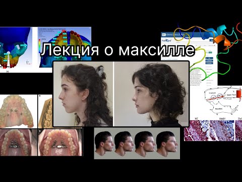 Видео: Лекция о максилле #looksmaxxing #maxilla #jaw #bp #beauty