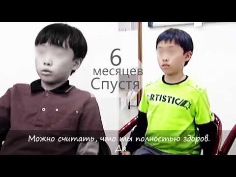 Видео: Нервный тик / Синдром Туретта, Многие люди страдают от боли из-за нервных тиков