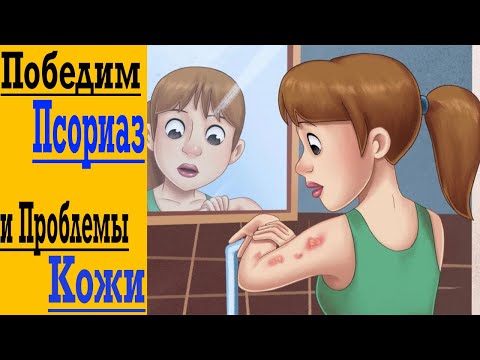Видео: Победим Навсегда Псориаз и Проблемы Кожи !