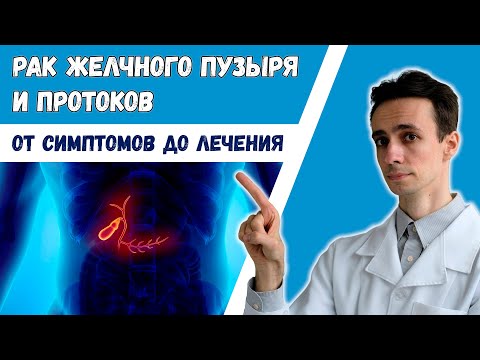 Видео: Рак желчных протоков и желчного пузыря. Холангиокарцинома. Вся информация