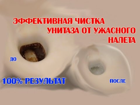 Видео: Как отчистить унитаз от ужасного налета