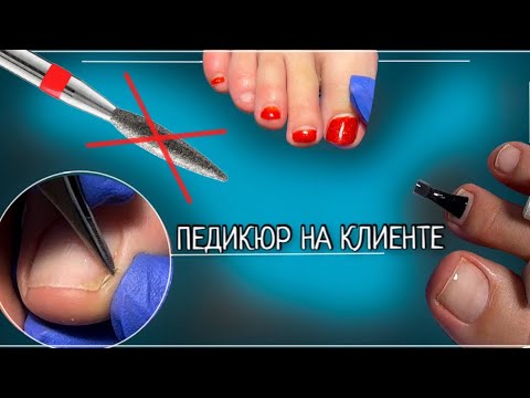 Видео: ПЕДИКЮР на клиенте🦶🏻Долой пламя?😬Какие фрезы я предпочитаю в работе🧐