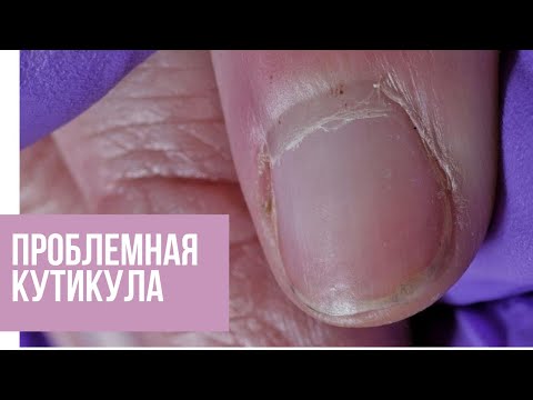 Видео: ПРОБЛЕМНАЯ кутикула. АППАРАТНЫЙ маникюр на тонкой налипшей кутикуле. Летний дизайн ногтей геометрия