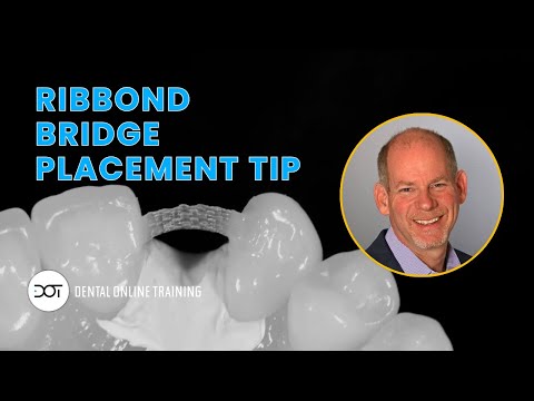 Видео: Наконечник для установки мостовидного протеза Ribbond — клинический мини-наконечник от доктора Де...