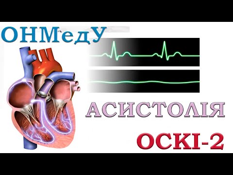 Видео: ОСКІ - 2. АСИСТОЛІЯ /БПЕА