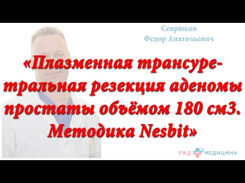 Видео: Плазменная трансуретральная резекция аденомы простаты объёмом 180 см3.  Методика Nesbit.