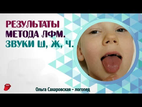 Видео: Паретическая форма дизартрии. Результаты Метода ЛФМ. Звуки Ш, Ж, Ч